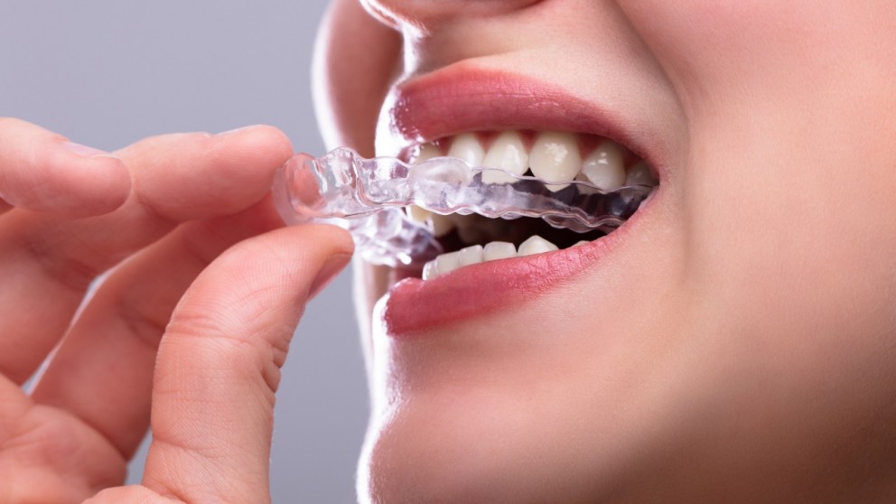 Ortodonzia presso Studio dentistico a Noale